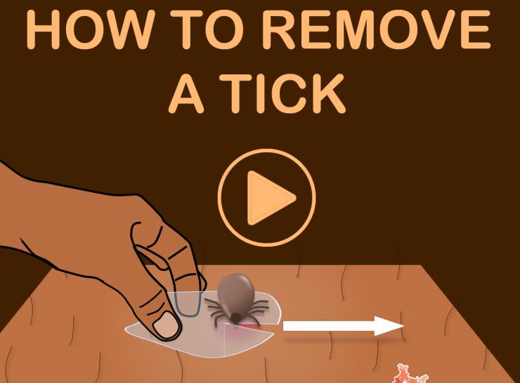 tick removal video link