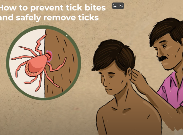 How to prevent tick bites and safely remove ticks